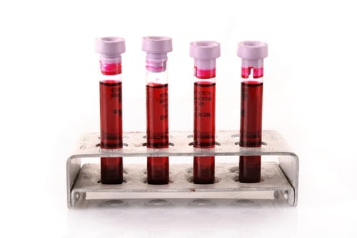 Here’s a similar concept. In medicine, a blood test can only tell you so much about your body. Sometimes you’ll need ultrasound, x-rays, urine, or other methods to fully diagnose the health of an individual. blood tests 4 min - How to Practice Feng Shui Holistically and Interpret It Correctly